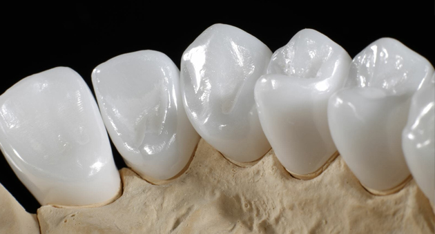 BỌC RĂNG SỨ ZIRCONIA – SỰ LỰA CHỌN HOÀN HẢO